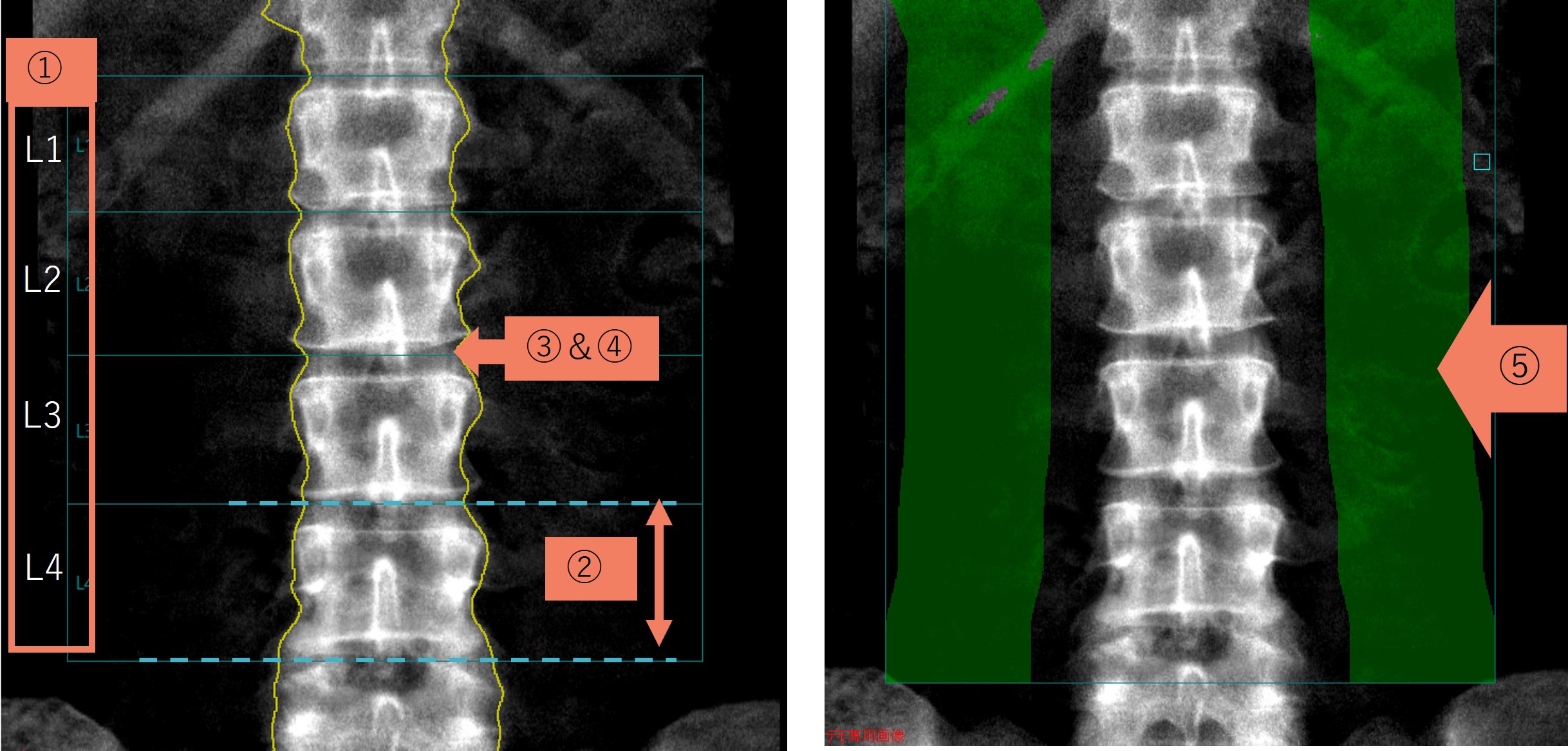 Technical Tips_term03.jpg